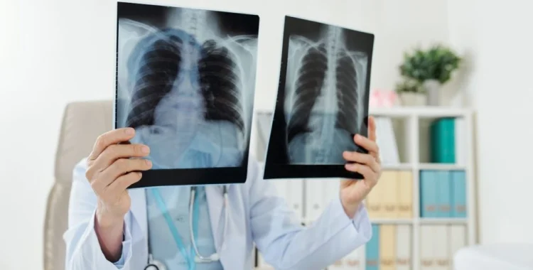 Пульмонолог