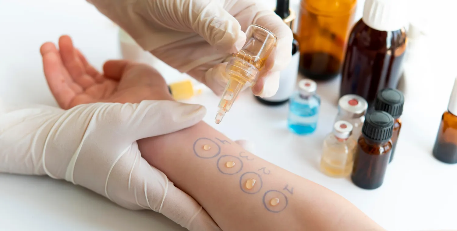 Аллерголог